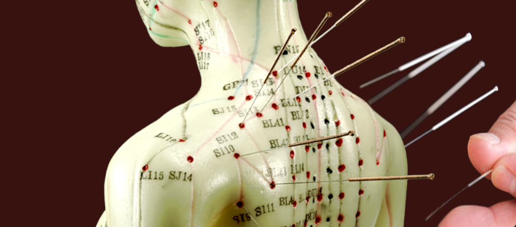 Acupuncture with Dr. Jeff Lan